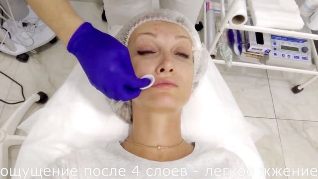 пилинг Джесснера смотреть онлайн