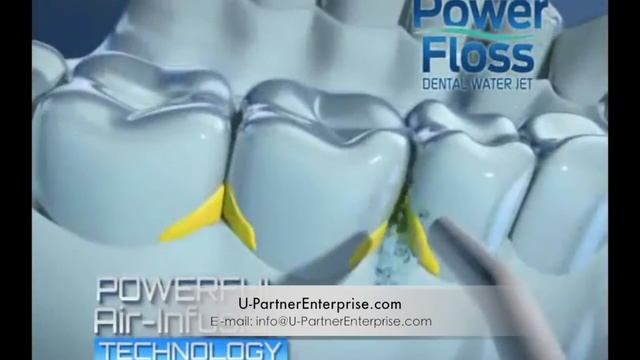 Power Floss Dental Water Jet, Oral Irrigator for Quick and Easy Dental Health & Hygiene沖牙器 洗牙機 смотреть онлайн