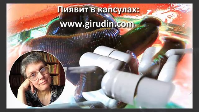 ПИЯВКИ ПРИ ИНСУЛЬТЕ, ЧЕМ ЗАМЕНИТЬ ПИЯВКУ? ЭКСТРАКТ ПИЯВКИ ПИЯВИТ, МОЙ ОПЫТ