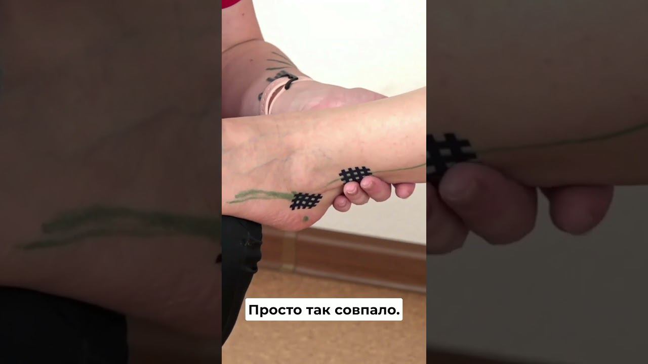 Знакомьтесь с методикой кросстейпирования в Учебном центре BBalance. Учитесь у профессионалов! смотреть онлайн