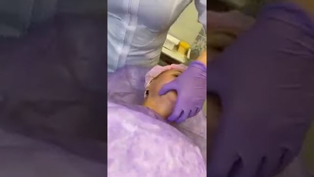 Медуспех. IGTV. Сочетание контурной пластики и нитевого лифтинга смотреть онлайн