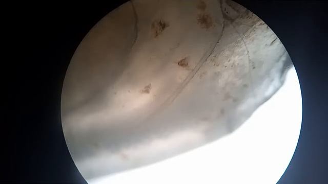 MICROSCÓPIO:Unha De Cachorro No Microscópio.Dog's Nail In The Microscope.Ноготь собаки в микроскопе