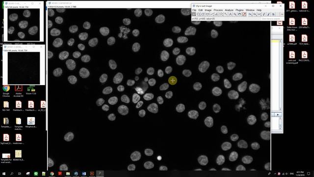 Template matching with ImageJ смотреть онлайн