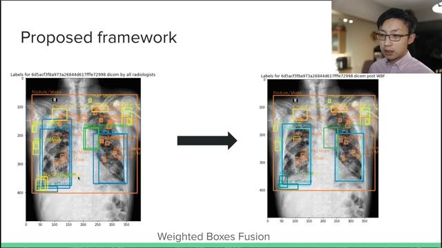 ATC-2021: Chest X-ray abnormalities localization via ensemble of deep convolutional neural networks смотреть онлайн