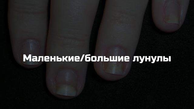 НОГТИ заранее предвещают о надвигающихся СТРАШНЫХ БОЛЕЗНЯХ. Как диагностировать болезни по ногтям смотреть онлайн