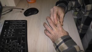 КАК СНЯТЬ КОЛЬЦО С ОПУХШЕГО ПАЛЬЦА