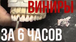 Виниры за 6 часов своими руками. Пошагово! Dental cad cam. Зубной техник обучение