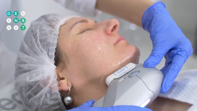 SMAS -лифтинг лица ULTRAFORMER (Ультраформер) Сеть клиник косметологии GEN87 смотреть онлайн