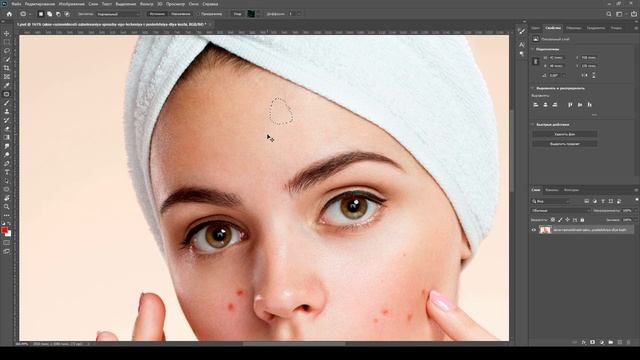Как удалить прыщи, морщины, угри в фотошопе // Adobe Photoshop смотреть онлайн