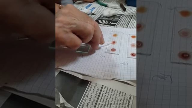Физиология. Кровь. 90А смотреть онлайн