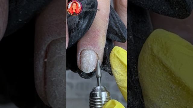 Маникюр после ожога ногтя / Что с ногтем? Что делать? Полная версия есть на канале! Прислать ссылку смотреть онлайн