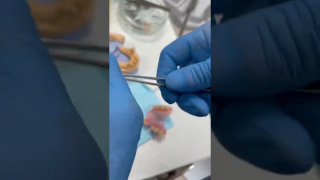 Частичный съёмный протез + коронки стоматология Челябинск смотреть онлайн