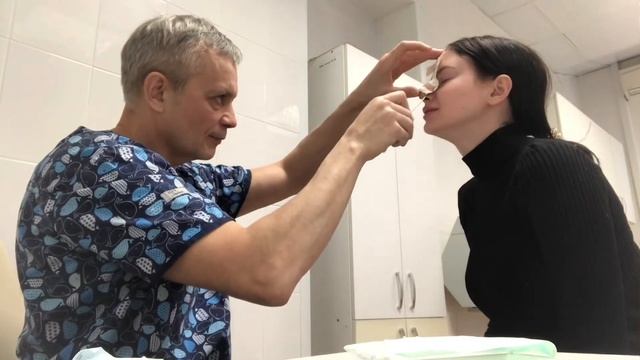 Ринопластика снятие гипса и швов смотреть онлайн