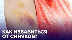 Как быстро УБРАТЬ СИНЯКИ? Самые ЭФФЕКТИВНЫЕ СПОСОБЫ