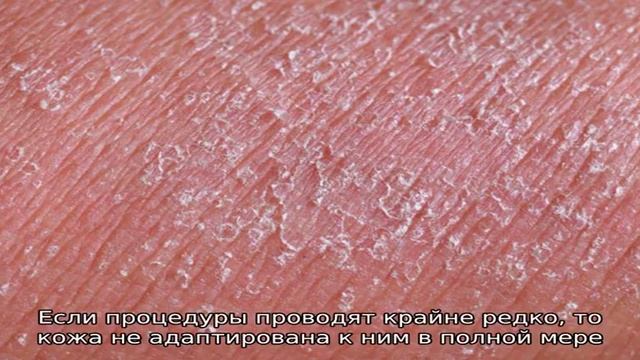 Раздражение и зуд у собаки после стрижки смотреть онлайн