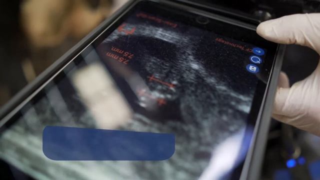 Easi-Scan:Go смотреть онлайн