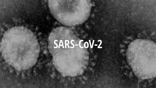 5 ПРИЗНАКОВ, ЧТО КОРОНАВИРУС У ВАС УЖЕ БЫЛ И САМ ПРОШЕЛ смотреть онлайн