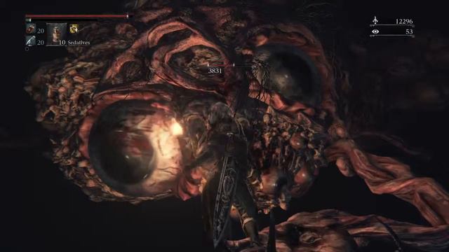 Bloodborne - Killing Brain of Mensis смотреть онлайн