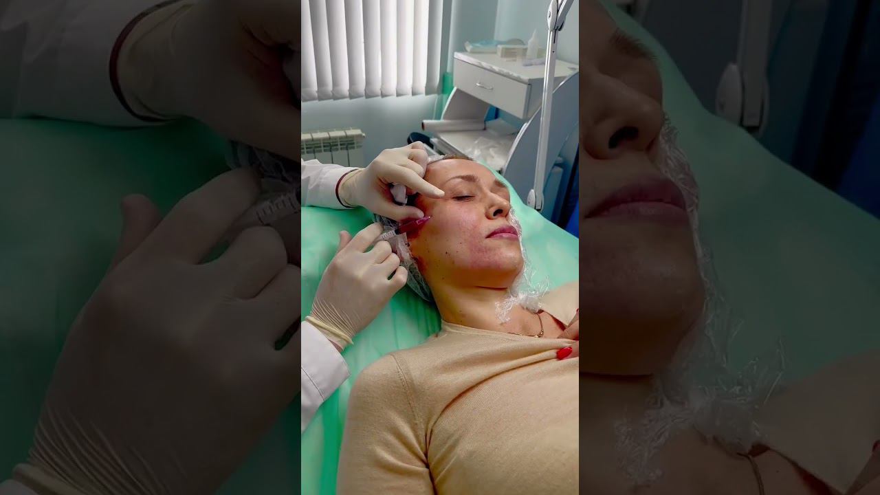 Знаете ли вы, что наши врачи-косметологи творят настоящие чудеса? Посмотрите до конца видео. #юмор смотреть онлайн