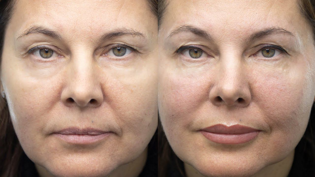 Освежитьлицо😍Выглядетьмоложе👌Утро без макияжа 💄 смотреть онлайн