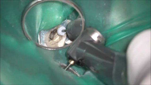 トライオートZX2（Tri Auto ZX2） смотреть онлайн