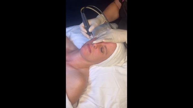 09:00 - Microdermabrasion смотреть онлайн