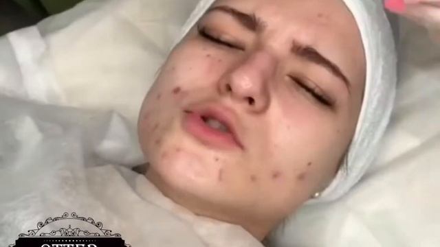 МИНДАЛЬНЫЙ ПИЛИНГ В OTTERSALON смотреть онлайн