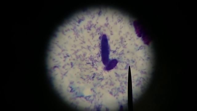 Graphic! 30 year old python with trichomonas, histomonas, fungal, bacterial enteritis смотреть онлайн