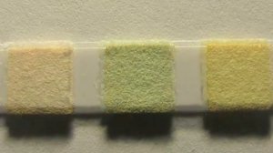 Биохимические тест-полоски, анализ  мочи