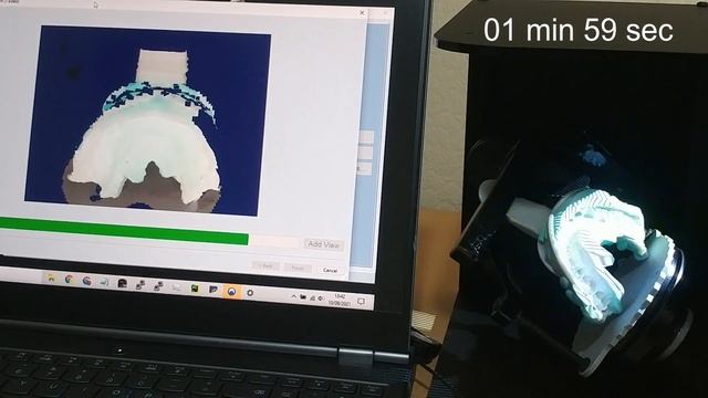 Tupel 3D Dental: Impression scanning смотреть онлайн
