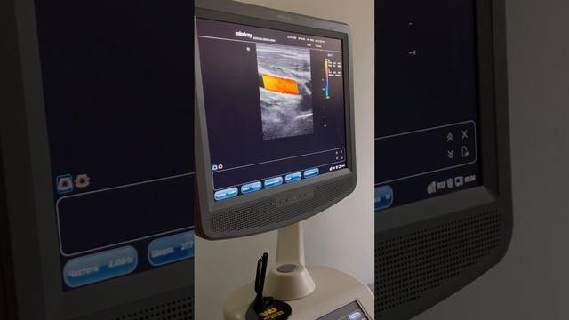 УЗИ БЦА.  Мастер класс от ассистента кафедры переподготовки ГГМУ Борсук Д.П.