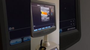 УЗИ БЦА.  Мастер класс от ассистента кафедры переподготовки ГГМУ Борсук Д.П.