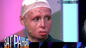 «За гранью»: «Распял и сжег!» | Выпуск от 22 января 2024 года