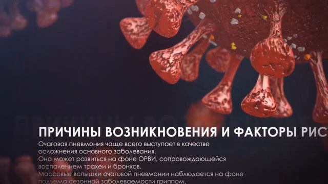 Очаговая двусторонняя пневмония смотреть онлайн