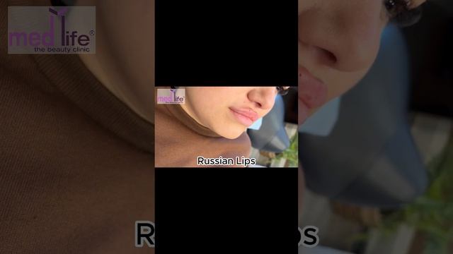 Antalya Dudak Dolgusu смотреть онлайн