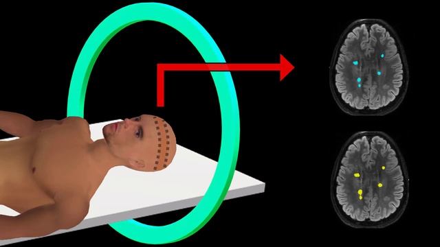 PET Scan | How It Works | Animation смотреть онлайн