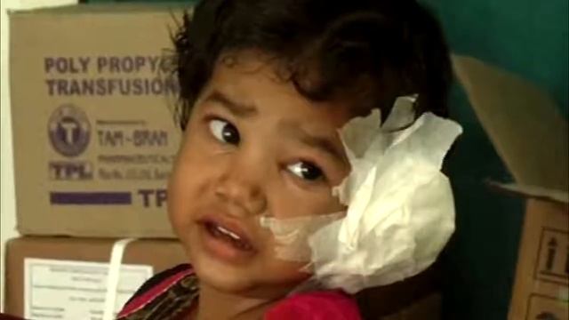 ТОП 10 ЖИВОТНЬІХ НАЙДЕННЬІХ В ЧЕЛОВЕЧИСКИХ УШАХ смотреть онлайн