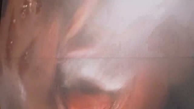A Nightmare on Elm Street 5-Freddy's ending смотреть онлайн