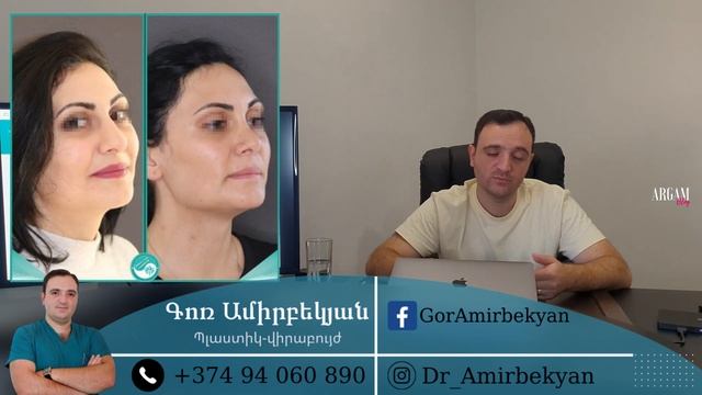 Գոռ Ամիրբեկյան / Ամեն ինչ քթի պլաստիկ վիրահատության մասին / Ռենոպլաստիկա / @ArgamBlog смотреть онлайн