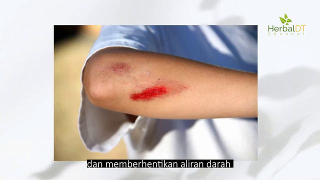 POKOK SENDUDUK UNTUK MERAWAT LUKA | herbadt смотреть онлайн