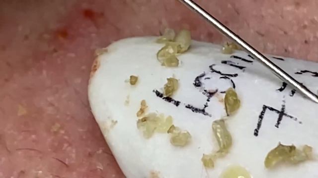 Enjoy Every Day With The Best Video Loan Nguyen Spa Official | 905 смотреть онлайн