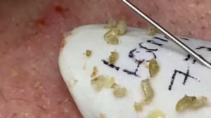 Enjoy Every Day With The Best Video Loan Nguyen Spa Official | 905