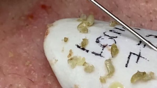 Enjoy Every Day With The Best Video Loan Nguyen Spa Official | 905