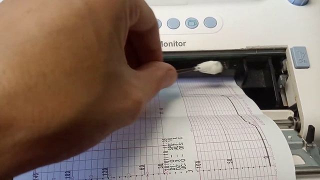 Фетальный монитор, кардиотокограф, монитор КТГ смотреть онлайн