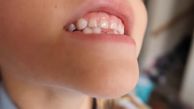 William's FIRST Dentist Appointment! смотреть онлайн