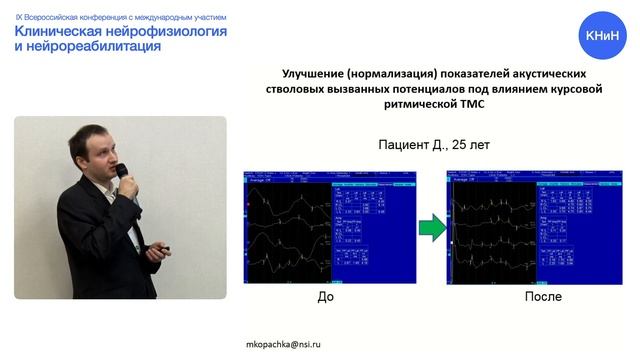 Эффекты ритмической ТМС в процессе восстановления пац-ов, перенёсших тяжелую черепно-мозговую травм смотреть онлайн