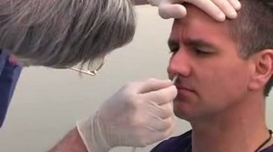 Постановка назогастрального зонда