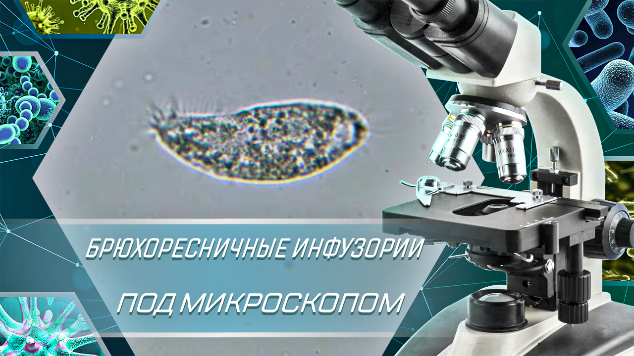Брюхоресничные инфузории под микроскопом | Hypotricha ciliates смотреть онлайн
