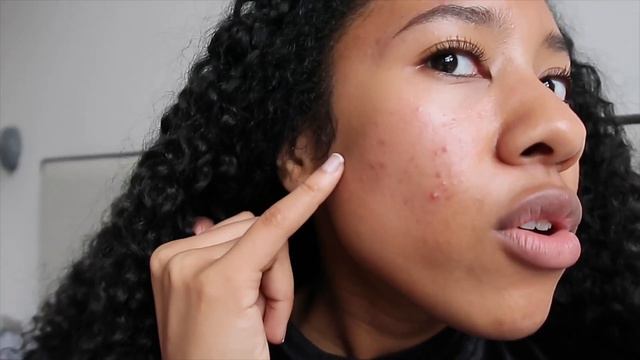I Used Dove Soap on My Face Everyday For a Month! смотреть онлайн