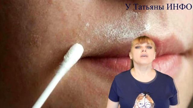 Как избавиться от ЖЕНСКИХ УСИКОВ в домашних условиях? смотреть онлайн